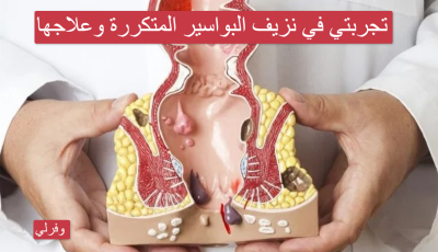 تجربتي في نزيف البواسير المتكررة وعلاجها